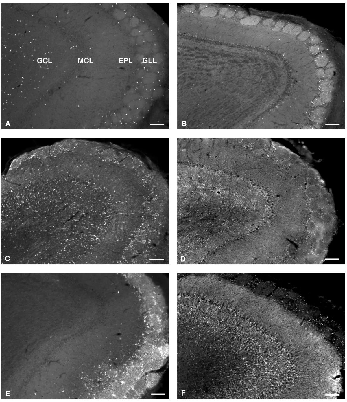 Adult Neurogenesis Debate in Human Brain