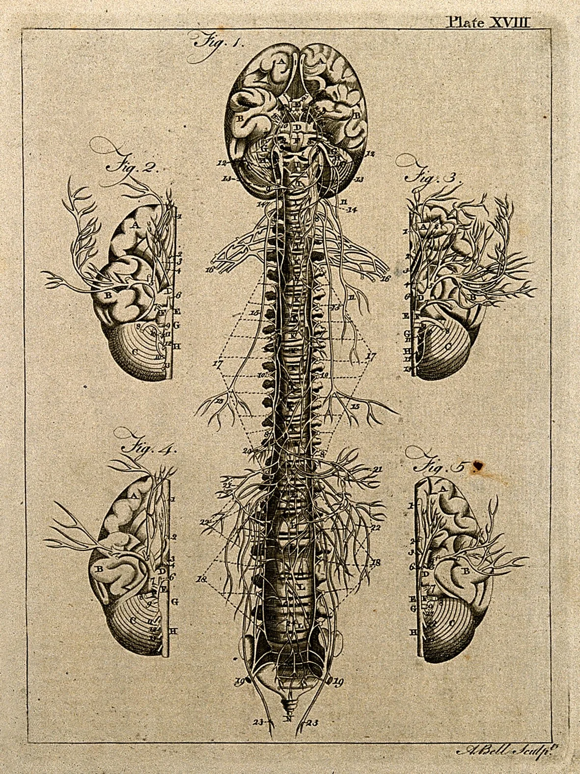 Five Brain Patterns Under One Depression Label